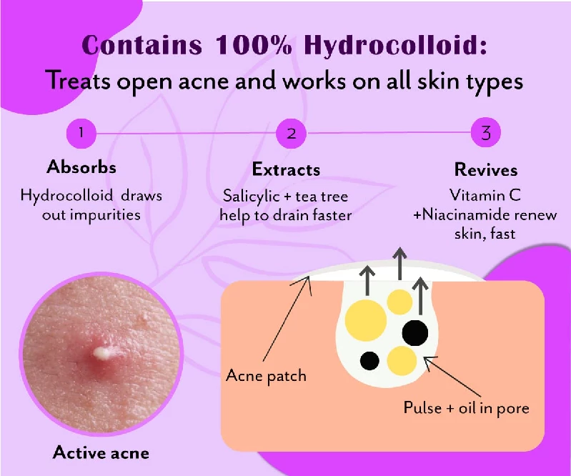 Urban Yog Acne Pimple Patch-Invisible Facial Stickers, Curvy Pimple Patch-3.webp